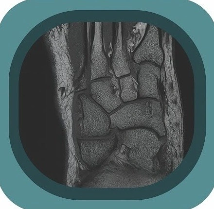 MRI mid foot anatomy icon